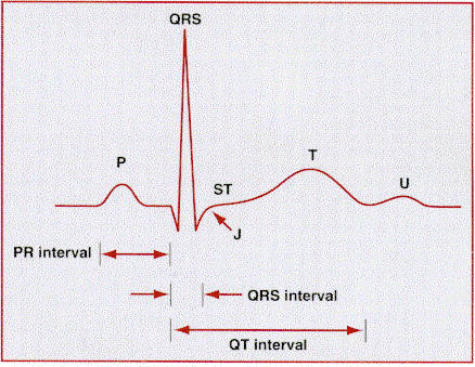 Description: ecg waveform